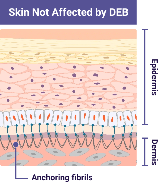Skin not affected by DEB