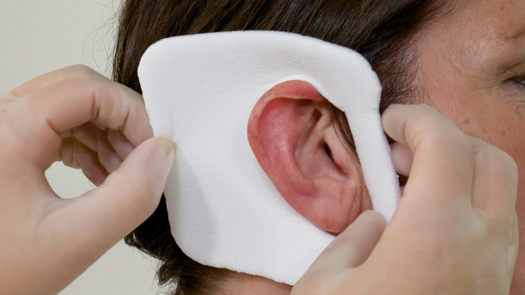 Ear dressing example