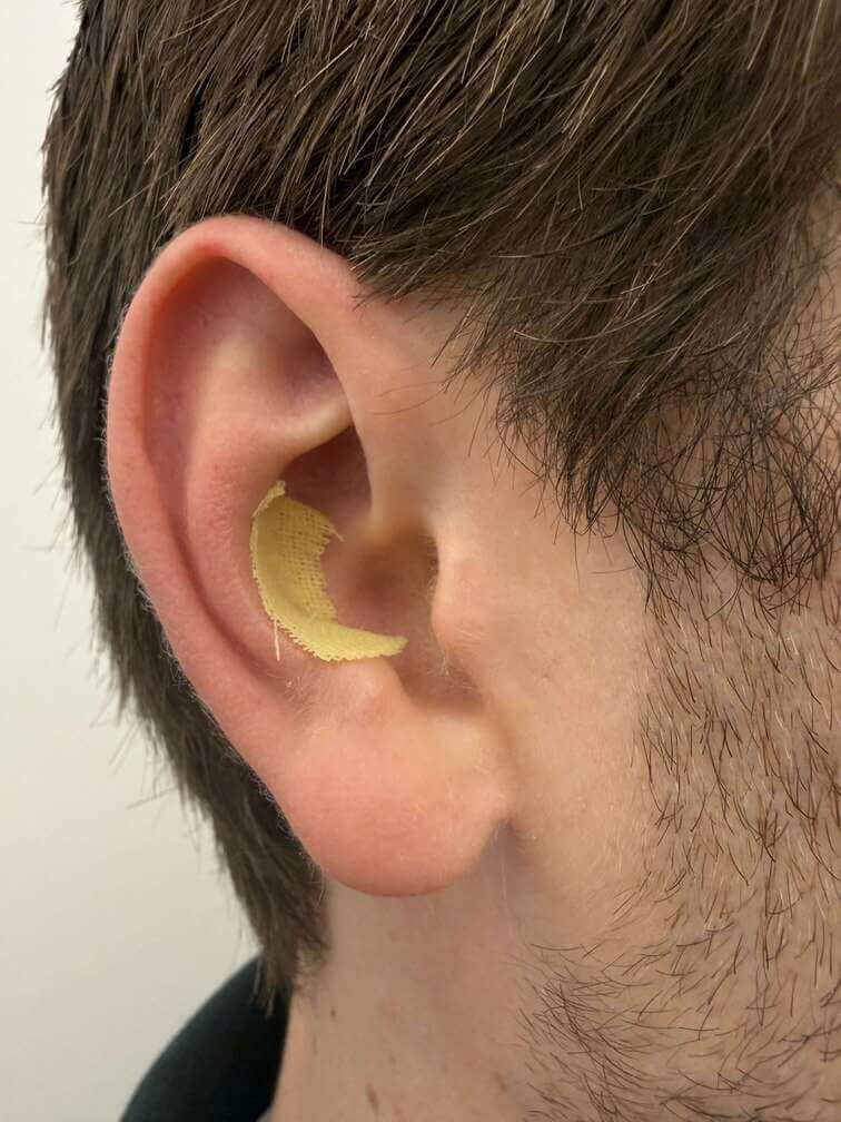 ear with bandage inside ear